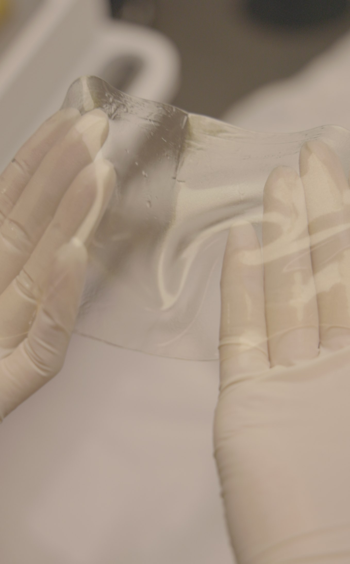 Gloved hands during an aesthetic procedure
