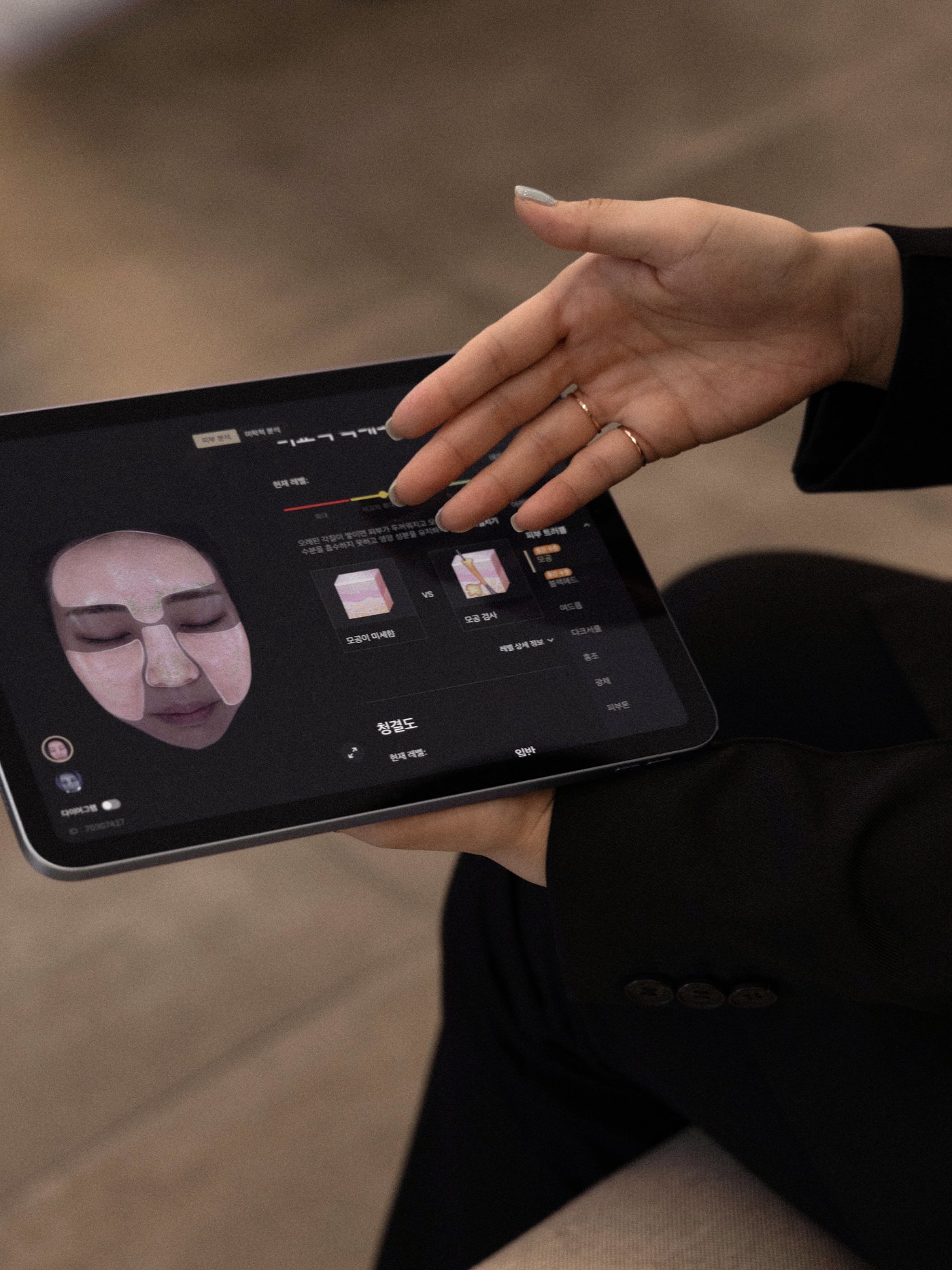 Clinician reviewing a skin analysis on a tablet